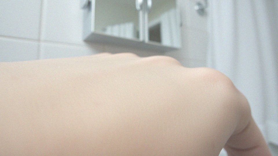 W jaki sposób gruczoły łojowe są związane z pryszczami?